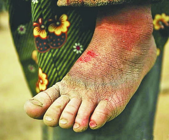 新昌:寒冬里的磚窯“花朵”