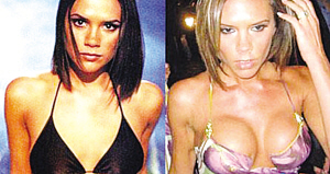 體壇明星整容大揭秘 劉翔整容為對(duì)得起觀眾