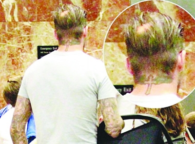 小貝遇“鬼剃頭” 36歲竟謝頂